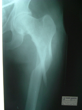 coimbatore-orthopaedic-joint-replacement-maternity-child-welfare-centre-india